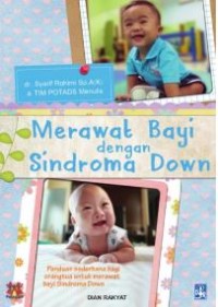 Merawat Bayi dengan Sindroma Down